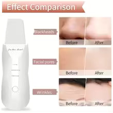 Electric Skin Scrubber & Facial Spatula